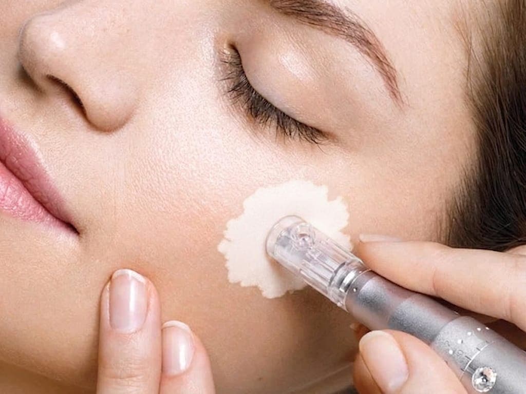 5FU Microneedling