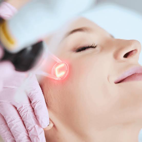 CO2 Laser for Acne Scars