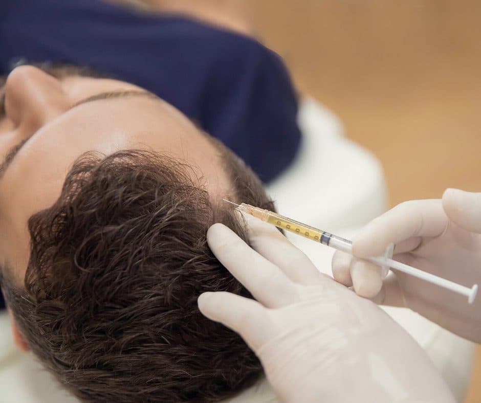 iPRF Scalp Care