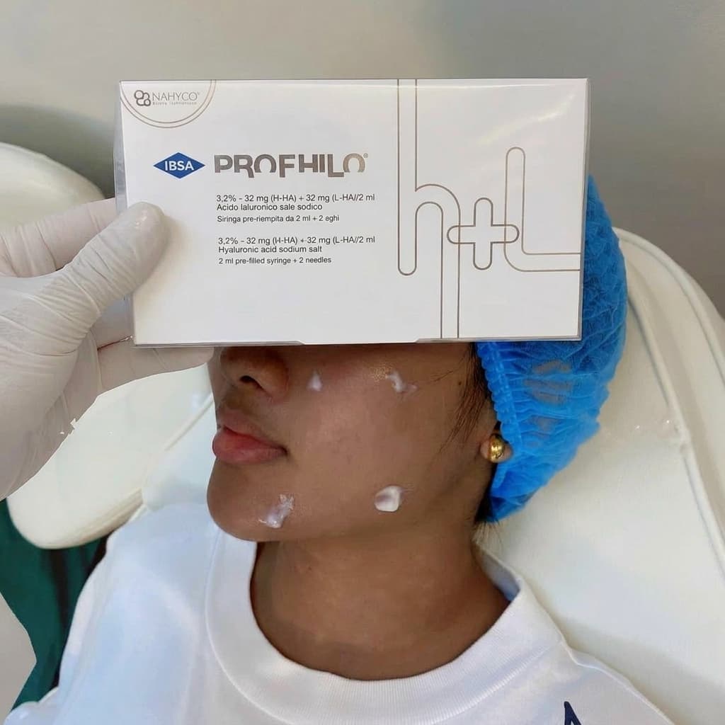 Profhilo